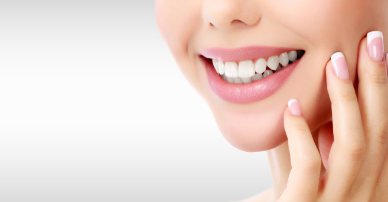 teeth whitening - MFCdental