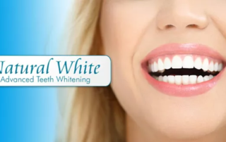 teeth whitening from MFCdental