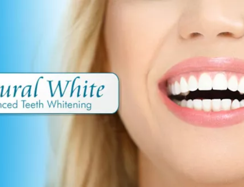 12 Tips Q&A for teeth whitening